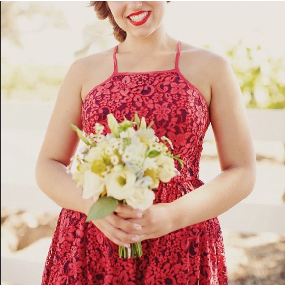 Tracy Reese Lace Event Dress - Picture 1 of 9